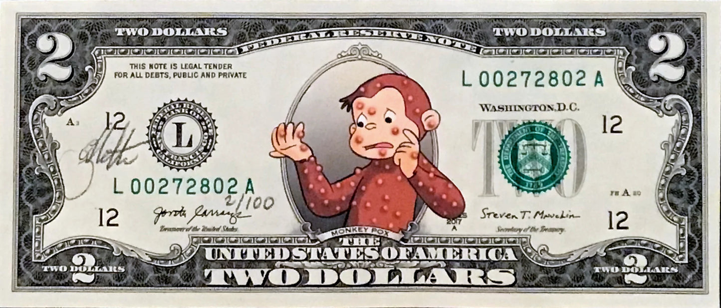 MPOX (Monkey Pox) Dollar